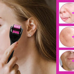 RODILLO DERMA FACIAL